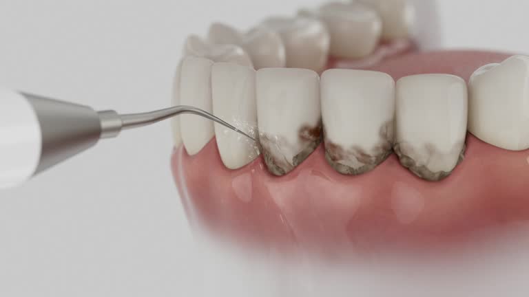 Reliable Dental contractor in Friend, NE by Smile Center Dentistry